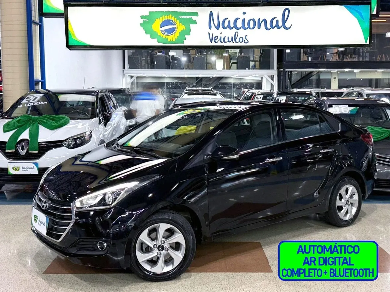 HYUNDAI HB20S 2016/2016